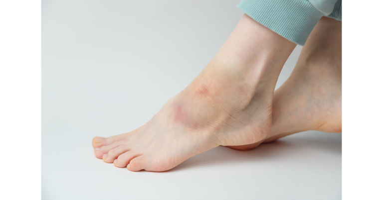 swelling in one leg